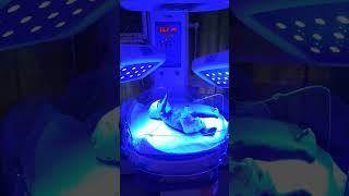 baby on phototherapy, bilirubin reduction by phototherapy#science #health #youtubeshorts #neet