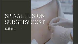 Spinal Fusion Surgery in India | Spinal Fusion Cost in India