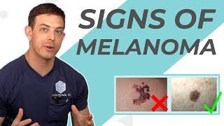 Signs of Skin Cancer! What to Look For | 208SkinDoc