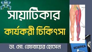 সায়াটিকার কার্যকর চিকিৎসা-ডা. জোবায়ের হোসেন II Treatment of Back Pain due to Sciatica