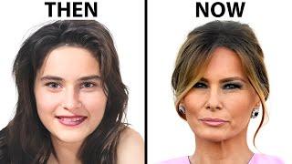 Melania Trump's NEW FACE | Plastic Surgery Analysis