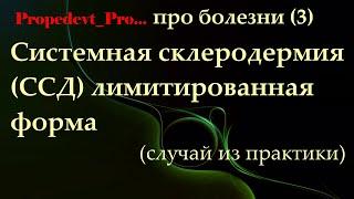 Системная склеродермия (ССД), лимитированная форма (случай из врачебной практики).