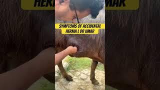 Symptoms of hernia l dr Umar Khan