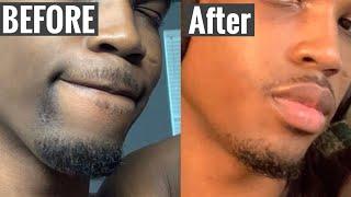 STOP SHAVING !!! DO THIS INSTEAD ( How To Get Rid Of Hyperpigmentation From Shaving For Men )