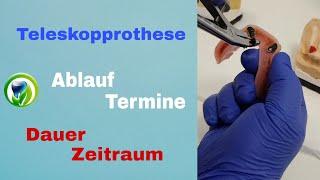 Die Teleskopprothese - Ablauf, Termine, Dauer  und Zeitraum