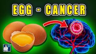 Don't ever eat eggs  like this! Causes cancer and memory loss! Solution ! Dr. John