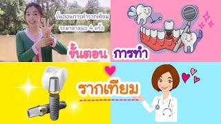 ขั้นตอนการทำรากเทียม