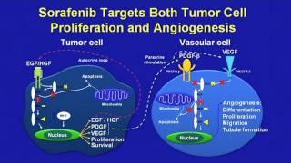 Hepatocellular Carcinoma - Molecular Approaches to Treatment