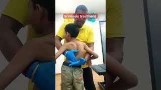 scoliosis treatment