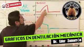 AVENTHO- Curvas en ventilación mecanica