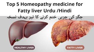 Fatty Liver Treatment Homeopathy Chelidonium, Carrudas marr, aftab homeo tips