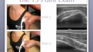 Don Buford MD 13 Point Shoulder Ultrasound Exam