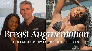 Amazing Natural Looking Breast Augmentation With Charity Lawson! | Barrett