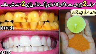 ThisHome Remedy Will Make Your Teeth Shine Like Pearl's In Just 2 Minute | Teeth Whitening At Home