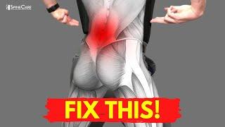 How to Fix Your Lower Back Pain for Good