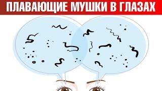 Как избавиться от мушек в глазах? Мушки перед глазами: причины