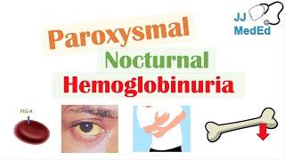 Paroxysmal Nocturnal Hemoglobinuria (PNH) | Causes & Pathogenesis, Symptoms, Diagnosis & Treatment