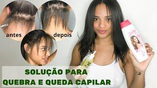 TRATAMENTO BARATINHO E DICAS PARA ACABAR COM A QUEDA E QUEBRA DO SEU CABELO | Kevileen Silva