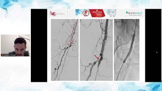 Participación Dr. Rubén Rodríguez Carvajal en Granada Peripheral Summit - Edición Online