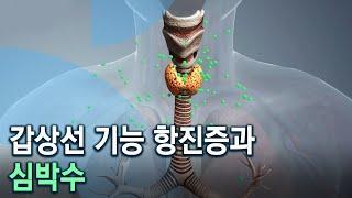 갑상선 기능 항진증과 심박수 - 당신의 심박수는 몇입니까? (KBS_764회_20210210)