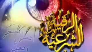 الرقيه الشرعيه ماهر المعيقلي ايات علاج العين و الحسد و ايات الشفاء مكرره