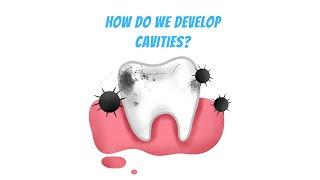 How cavities develops from Tooth decay? (3D animation)