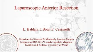 Clinical performances in Laparoscopic Surgery with MEDILINE MIS Solutions (L. BONI, MD, FACS)