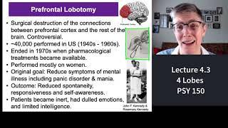 150 Lecture 4.3 Brain Lobes and Lobotomies