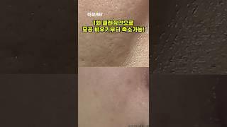 씻어서 모공 줄이는 법 #메디필 #폼클렌징추천 #올리브영폼클렌징 #올리브영클렌저 #shorts