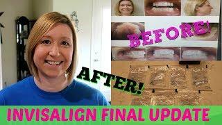 FINAL INVISALIGN UPDATE || END RESULTS