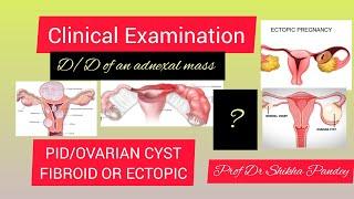 Gynecology clinical examination basics@saisamarthgyneclasses