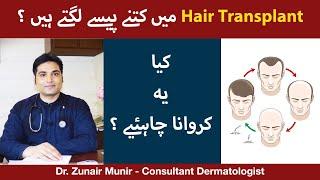 Hair Transplant Price In Pakistan | Hair Transplant Kaise Hota Hai | Is Hair Transplant Painful?