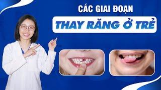 Các Giai Đoạn Thay Răng Ở Trẻ Nhỏ | Nam Bùi Vinalign