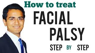 Facial palsy (Bell's Palsy) Treatment, Upper and Lower motor neuron (UMN vs LMN), Symptoms, USMLE