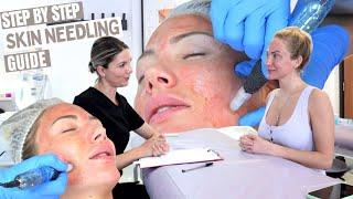 7 Step Skin Needling Treatment | Step By Step Procedure Performance Tutorial | Level 4 VTCT Course