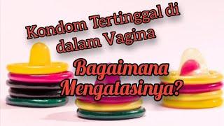 KONDOM TERTINGGAL DI DALAM  VAGINA.... BAGAIMANA MENGATASINYA ???...