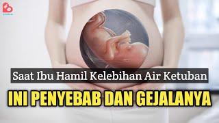 Penyebab dan Tanda Ibu Hamil Kelebihan Air Ketuban