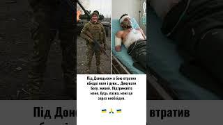 Під Донецьком в бою втратив обидві ноги і руки... Дякувати Богу, живий. Підтримайте мене...