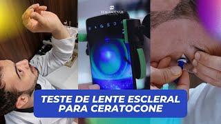 TESTE de LENTE ESCLERAL para CERATOCONE | Dr. Tiago César