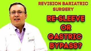 Revision Weight Loss Surgery (Sleeve to Bypass) – Cancun Bariatric Surgeon Explains