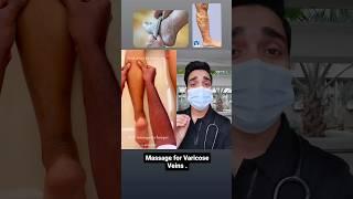 Massage for Varicose Vein.