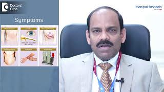 What Is The Prognosis For Liver Cancer? Best Hepatologist In India - Dr. Olithselvan - Manipal