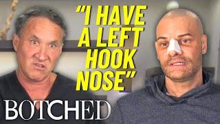 The Boxer With A Left Hook Nose FULL TRANSFORMATION | Botched | E!