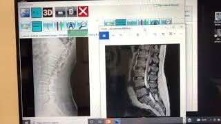 X-ray vs MRI when is one better