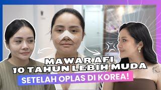 Mawar AFI 10 Tahun Lebih Muda Setelah Operasi Plastik Di Korea!