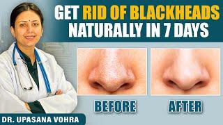 Skin Transformation Challenge | Remove Blackhead Naturally in 7 Days | Upasana Ki Duniya