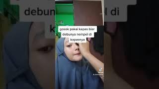 Tahap penting agar muka bebas komedo dan jerawat