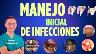 Manejo inicial de infecciones   con CMF Angel Renteria