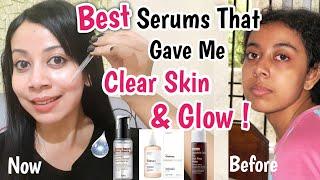 Best Serums That Helped Me Get Clear Skin & Glow!