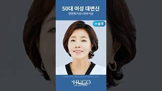 안면거상 & 이마거상 수술 50대 여성 전후 변화 #팔자주름 #안면거상